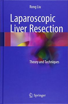 portada Laparoscopic Liver Resection: Theory and Techniques 