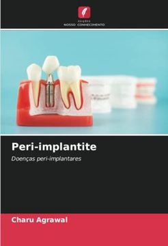 portada Peri-Implantite: Doenças Peri-Implantares