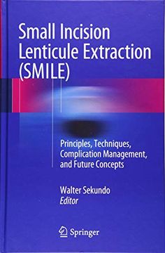 portada Small Incision Lenticule Extraction (Smile): Principles, Techniques, Complication Management, and Future Concepts (en Inglés)