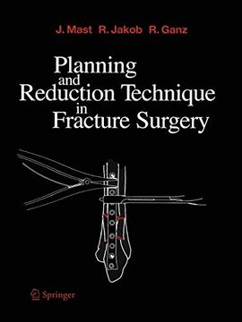 portada Planning and Reduction Technique in Fracture Surgery (en Inglés)