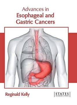 portada Advances in Esophageal and Gastric Cancers 