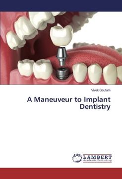portada A Maneuveur to Implant Dentistry