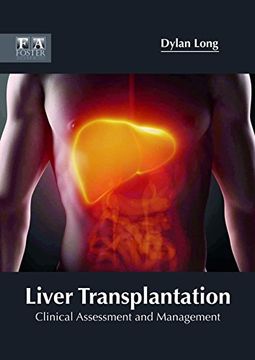 portada Liver Transplantation: Clinical Assessment and Management (en Inglés)
