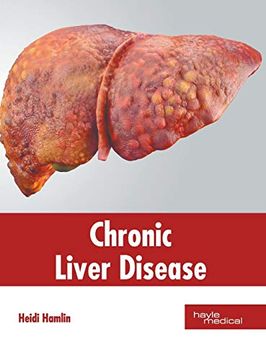 portada Chronic Liver Disease (en Inglés)