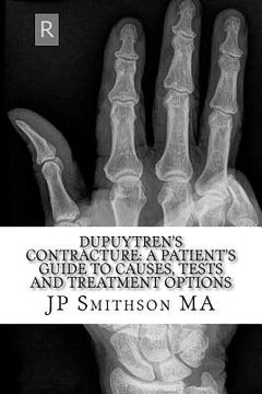 portada Dupuytren's Contracture: : A Patient's Guide to Causes, Tests and Treatment Option (in English)