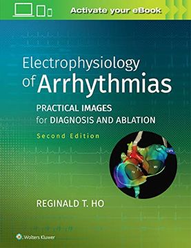 portada Electrophysiology of Arrhythmias: Practical Images for Diagnosis and Ablation (en Inglés)