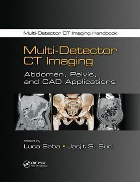 portada Multi-Detector CT Imaging: Abdomen, Pelvis, and CAD Applications (en Inglés)