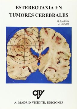 portada Estereotaxia en tumores cerebrales