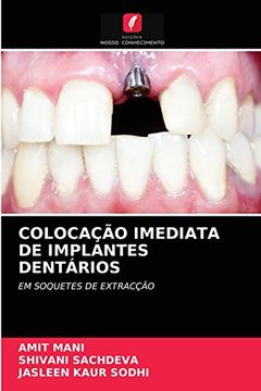 portada Colocação Imediata de Implantes Dentários (en Portugués)