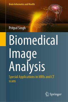 portada Biomedical Image Analysis: Special Applications in Mris and CT Scans (en Inglés)