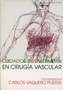 Cuidados de Enfermería en Cirugía Vascular