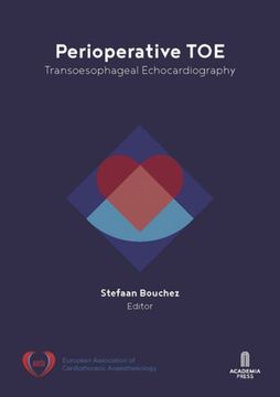 portada Perioperative Toe: Transoesophageal Echocardiography