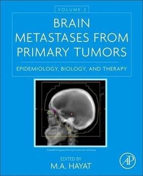 portada Brain Metastases from Primary Tumors, Volume 2: Epidemiology, Biology, and Therapy