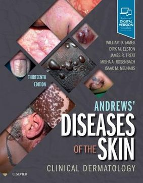 portada Andrews' Diseases of the Skin: Clinical Dermatology, 13e (in English)