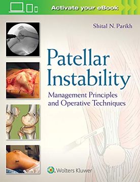 portada Patellar Instability: Management Principles and Operative Techniques (in English)