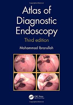 portada Atlas of Diagnostic Endoscopy, 3e 