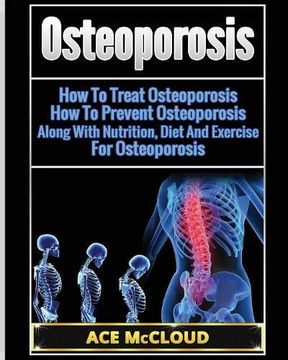 portada Osteoporosis: How To Treat Osteoporosis: How To Prevent Osteoporosis: Along With Nutrition, Diet And Exercise For Osteoporosis