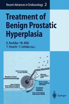 portada treatment of benign prostatic hyperplasia (en Inglés)