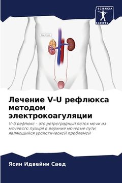 portada Лечение V-U рефлюкса метод&#10 (en Ruso)