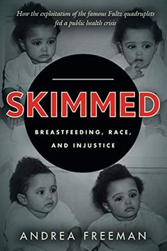 portada Skimmed: Breastfeeding, Race, and Injustice (en Inglés)