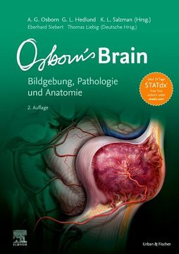 portada Osborn's Brain -Language: German (en Alemán)