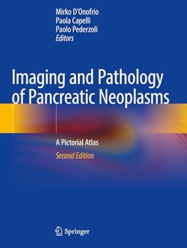 portada Imaging and Pathology of Pancreatic Neoplasms: A Pictorial Atlas (in English)