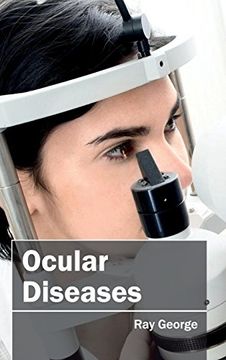 portada Ocular Diseases (en Inglés)