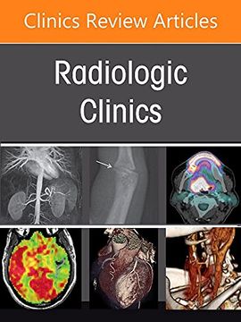 portada Hepatobiliary Imaging, an Issue of Radiologic Clinics of North America (Volume 60-5) (The Clinics: Internal Medicine, Volume 60-5) (en Inglés)