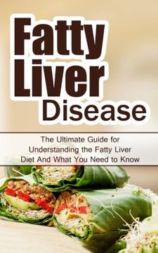 portada Fatty Liver Disease: The Ultimate Guide for Understanding the Fatty Liver Diet And What You Need to Know (FLD, Alcohol, NAFLD, Metabolic Syndrome, Steatosis, Alcoholic Liver Disease, Obesity)