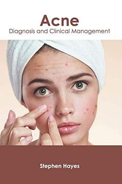 portada Acne: Diagnosis and Clinical Management (in English)