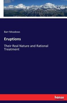 portada Eruptions: Their Real Nature and Rational Treatment (en Inglés)