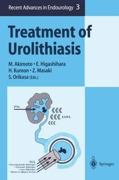 portada Treatment of Urolithiasis (Recent Advances in Endourology) (en Inglés)