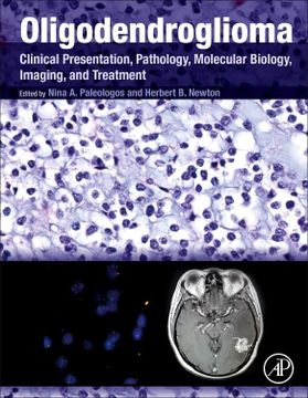 portada Oligodendroglioma: Clinical Presentation, Pathology, Molecular Biology, Imaging, and Treatment (en Inglés)
