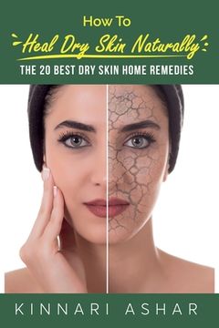 portada How to Heal Dry Skin Naturally: The 20 Best Dry Skin Home Remedies