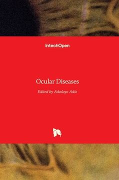 portada Ocular Diseases (en Inglés)