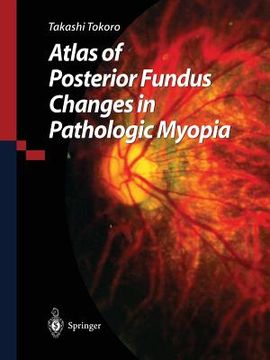portada Atlas of Posterior Fundus Changes in Pathologic Myopia (en Inglés)