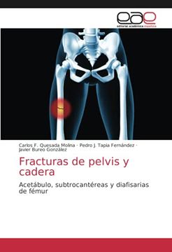 portada Fracturas de Pelvis y Cadera: Acetábulo, Subtrocantéreas y Diafisarias de Fémur (in Spanish)