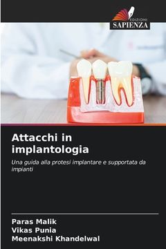 portada Attacchi in implantologia (in Italian)