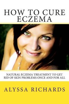 portada How To Cure Eczema: Natural Eczema Treatment To Get Rid Of Skin Problems Once And For All (in English)