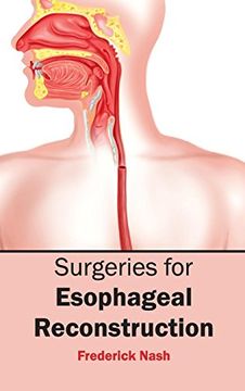 portada Surgeries for Esophageal Reconstruction (in English)