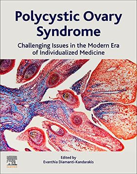 portada Polycystic Ovary Syndrome: Challenging Issues in the Modern era of Individualized Medicine (in English)