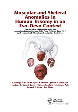 portada Muscular and Skeletal Anomalies in Human Trisomy in an Evo-Devo Context: Description of a t18 Cyclopic Fetus and Comparison Between Edwards (T18),. 3-d Imaging and Anatomical Illustrations (in English)