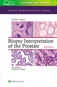 Biopsy Interpretation of the Prostate (en Inglés)