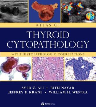 portada atlas of thyroid cytopathology with histopathologic correlations (en Inglés)