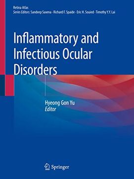 portada Inflammatory and Infectious Ocular Disorders (en Inglés)
