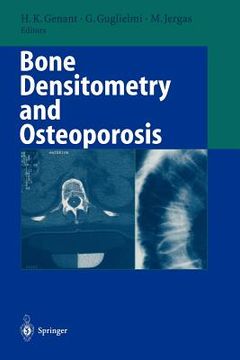portada bone densitometry and osteoporosis (in English)