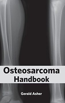portada Osteosarcoma Handbook (en Inglés)
