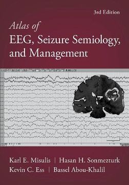 portada Atlas of Eeg, Seizure Semiology, and Management 