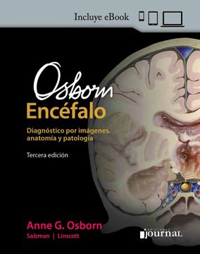 portada Osborn EncéFalo. DiagnóStico por ImáGenes, AnatomíA y PatologíA