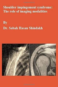 portada Shoulder Impingement Syndrome: The Role of Imaging Modalities: Master Thesis (en Inglés)